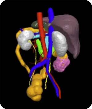 Patient-specific 3D model
